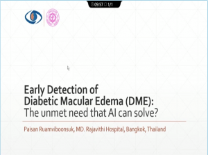 Paisan Ruamviboonsuk - Early Detection of DME: An Unmet Need that AI can Solve?