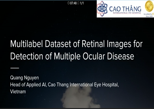 Quang Nguyen – Multilabel Dataset of Retinal Images for Detection of Multiple Ocular Diseases